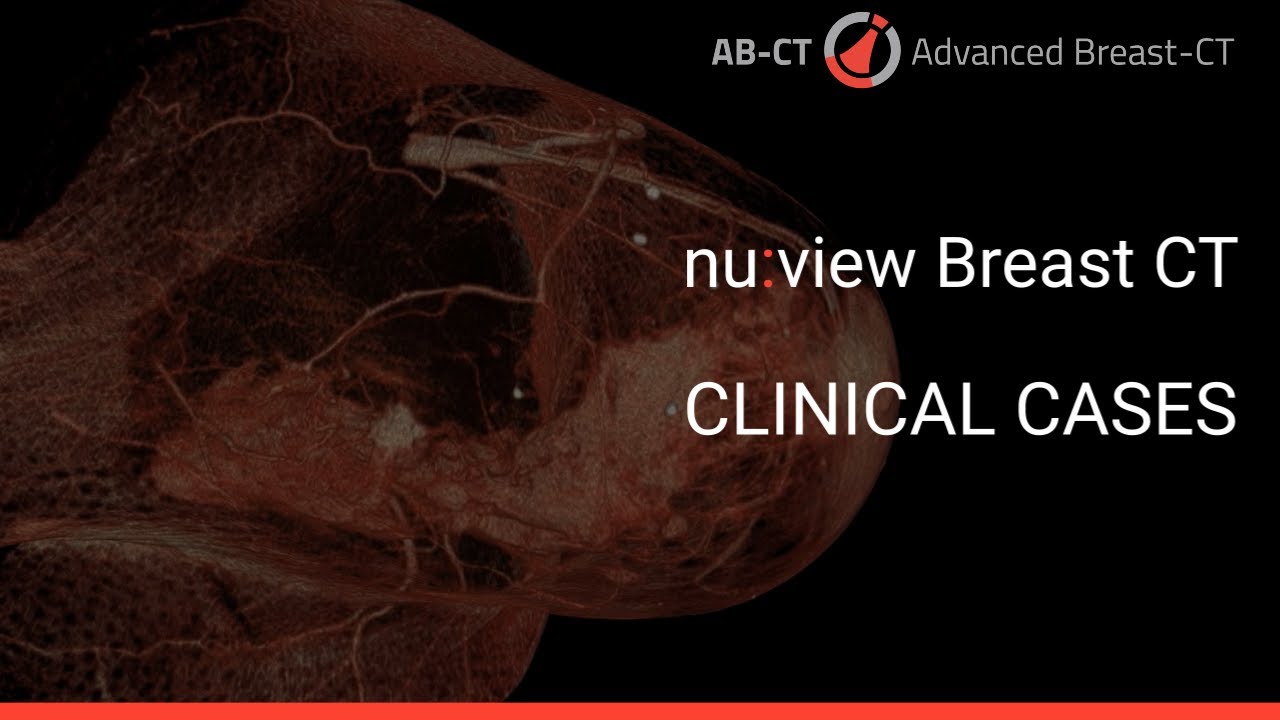 nu:view Breast CT: Clinical Case Examples