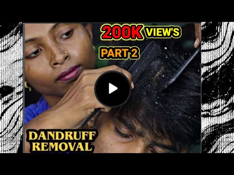 DANDRUFF REMOVAL TREATMENT || HAIR SCRATCHING GIRL || ASMR FUNNY BARBER