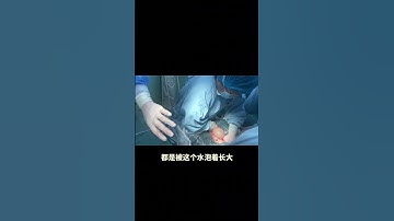 Thumbnail of #shorts#newborns #baby #pregnant women giving birth#multiple births #Twin babies