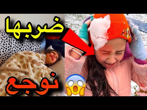 خبط عينهالكن الله أخذ حقها