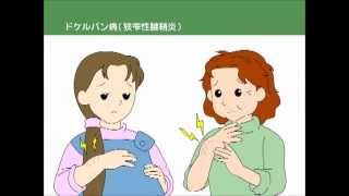 ドケルバン病(狭窄性腱鞘炎)