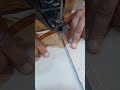 Eearwax Removal Daily- Enjoy Your Day With Dr Smile