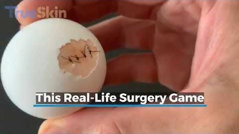 Egg Surgery Challenge