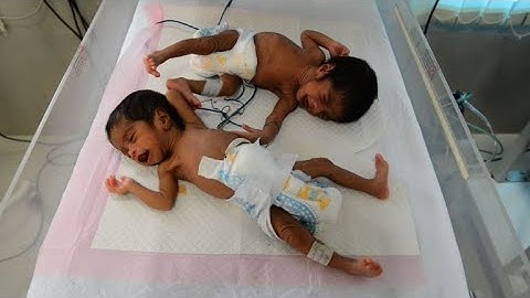 15,000 under fives die from preventable illnesses each day: UN