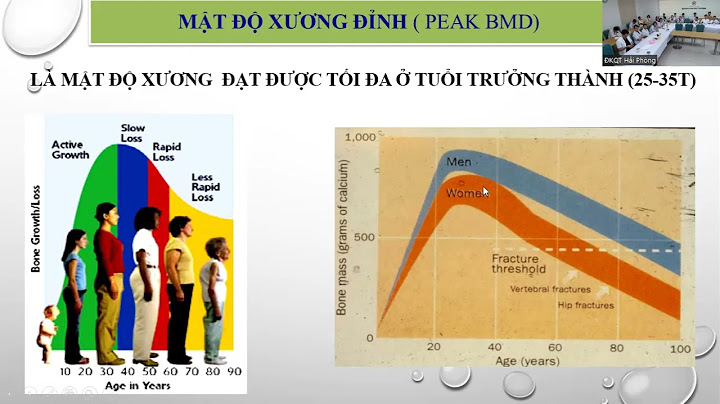 Maật độ xung quanh trong đo lường là gì năm 2024