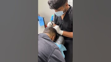 Scalp micropigmentation for density build up.8891426652 8078800335 #scalpmicropigmentation #smp