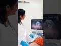 Growth and Doppler scam for baby growth ♥️ by Dr Shraddha Agarwal #babydevelopment #hospitallife