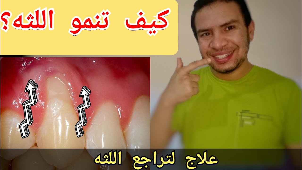 كيف تصلح تراجع اللثه و تعيد نمو اللثه المنحسره في المنزل بنفسك