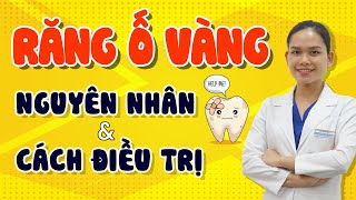 Top 14 cách làm trắng răng vàng bẩm sinh hay nhất năm 2022