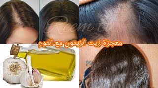 وصفة خطيرة/ معجزة زيت الزيتون والثوم سبحان الله ينبت الشعر حتى لوكان اصلع ويوقف تساقط يملاءالفراغات