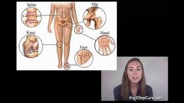 How To Heal Psoriasis Part 5