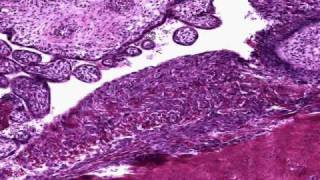 Histología de placenta