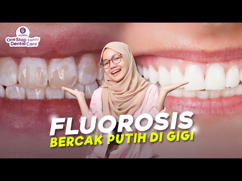 Video: 3 Cara Menghilangkan Bintik Putih pada Gigi