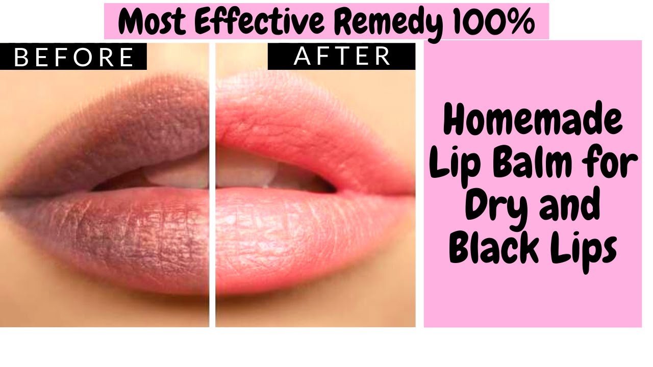 Homemade Lip Balm Get Pink Lips Permanently at Home Lip Balm for