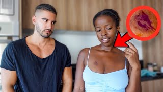 HICKEY PRANK ON BOYFRIEND !! *HE CRIES*