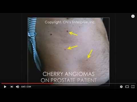 Dr Chi's Fingernail