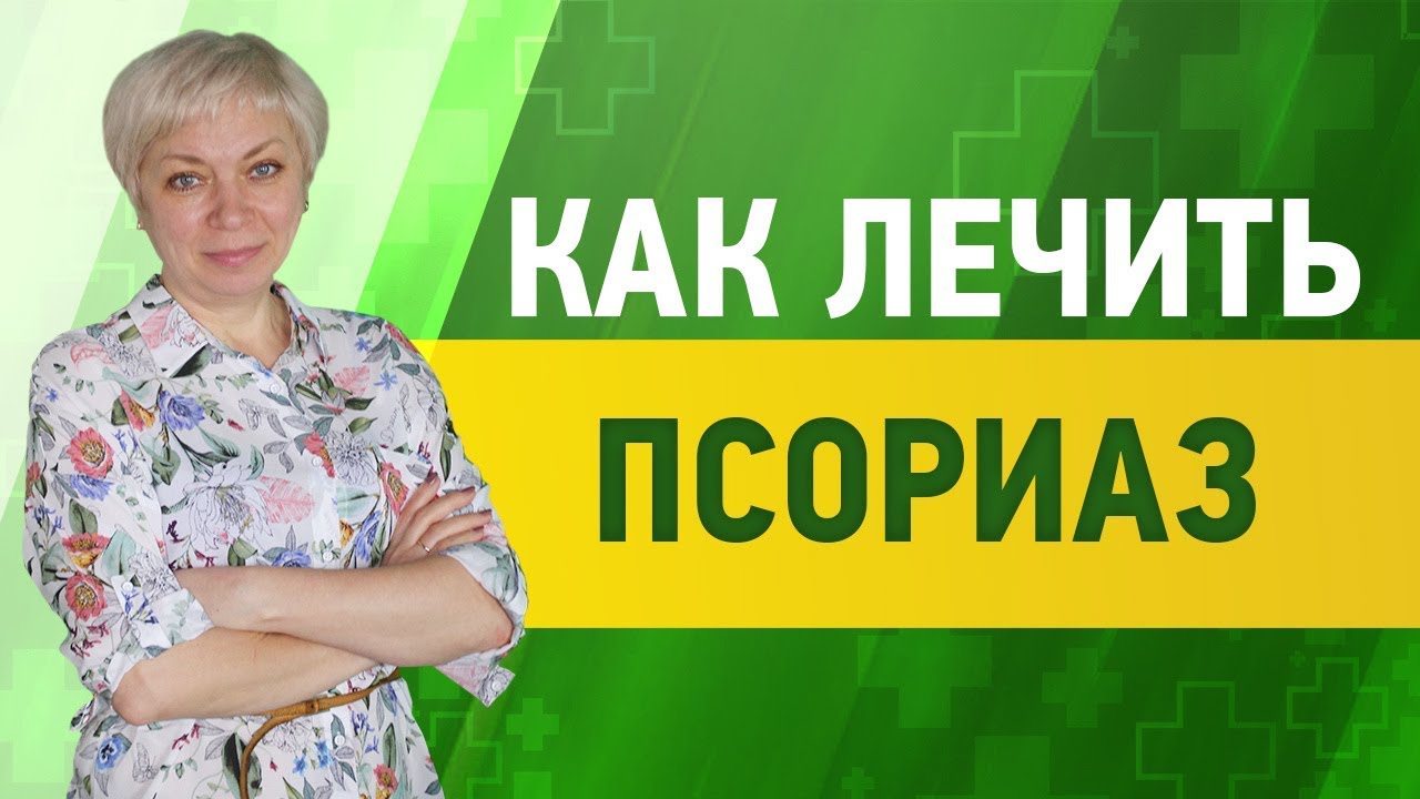 Лечение псориаза | Делайте это КАЖДЫЙ ДЕНЬ