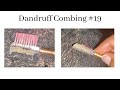 Dandruff combing #19