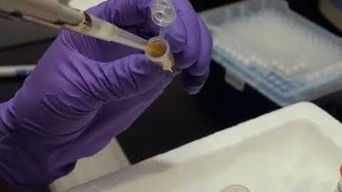 Isolation and Profiling of MicroRNA Exosomes