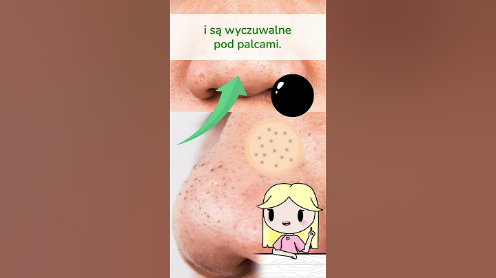 Włókna łojowe, czy wągry. Jak je odróżnić? | W Krainie Składów #kosmetyki #skincare #ciekawostki