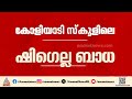 ഷിഗെല്ല ബാധ; പ്രതിരോധ പ്രവർത്തനങ്ങൾ ആരംഭിച്ചു, പ്രദേശത്തെ കിണറുകൾ ക്ലോറിനേഷൻ ചെയ്യും