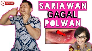 TIPS LULUS SYARAT GIGI MASUK POLWAN / PRAJURIT WANITA TNI | DOKTER GIGI WAWAN SUMANTRI | dentist