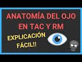 ANATOMÍA OCULAR👁️[en TOMOGRAFÍA y RESONANCIA MAGNÉTICA]