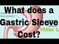 What does a Gastric Sleeve Cost. LAPAROSCOPIC SLEEVE GASTRECTOMY.