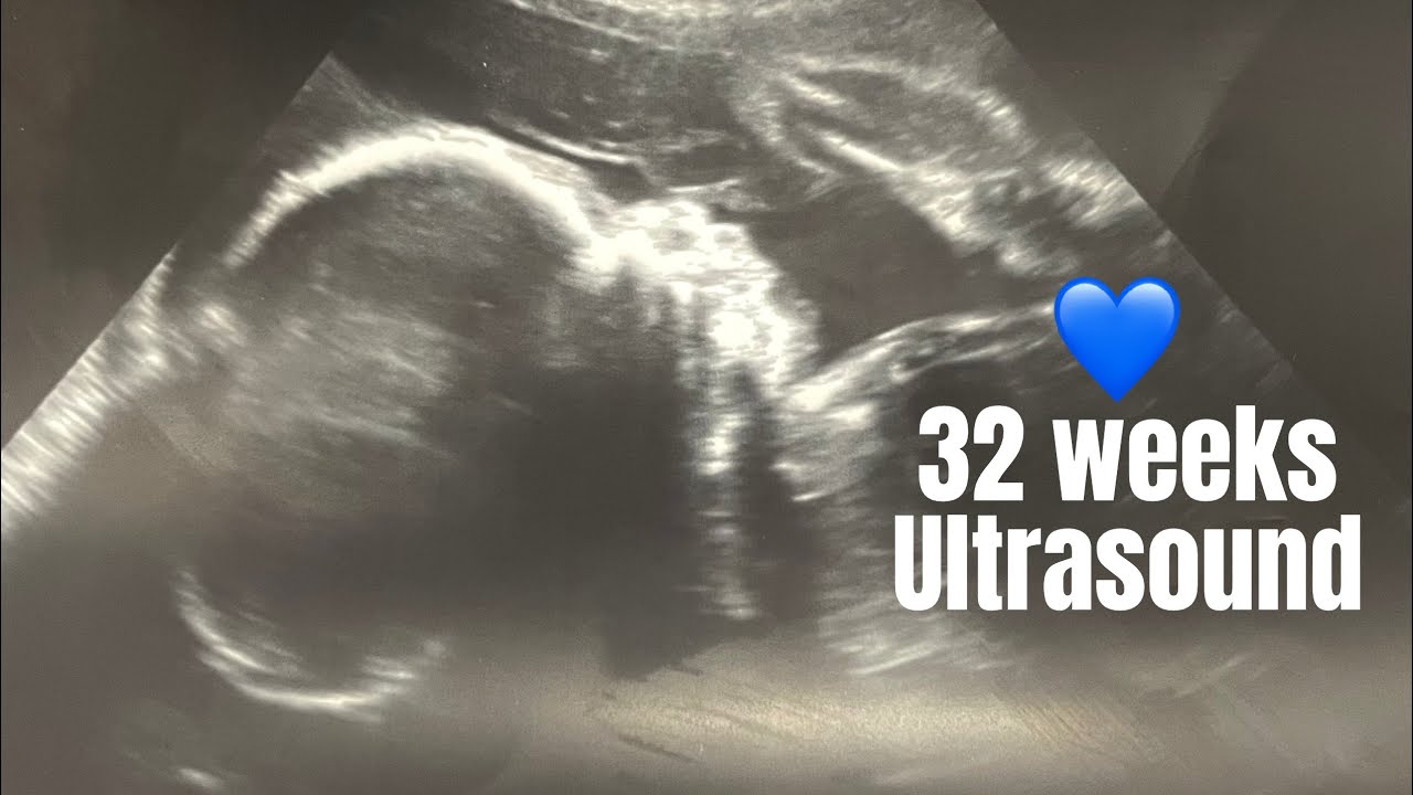 32 Weeks Pregnancy Ultrasound Baby Moving/Drinking YouTube