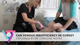 Medical Clinic: Can Venous Insufficiency Be Cured? | Vein Treatment Clinic New York 10016