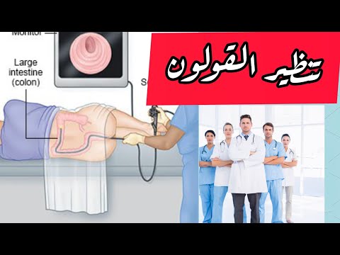 فيديو: هل يمكن إزالة السلائل أثناء التنظير السيني؟