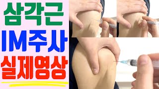 IM주사 **실제영상 총2회** / '코로나백신 이렇게 맞아요' / 삼각근 주사놓는법 / 근육주사놓는법 / IM놓는법