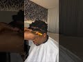 Loc Surgery Successful! 🏥 Sharpest Dreadlock Taper Fade 😱✂️ #Dreadlocks #Barber #Fade #SkinFade
