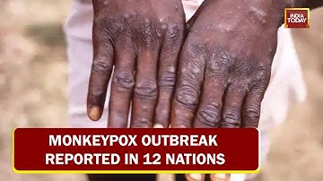 Rare Monkeypox Outbreak Reported In 12 Nations, New Viral Infection Raises Alarm