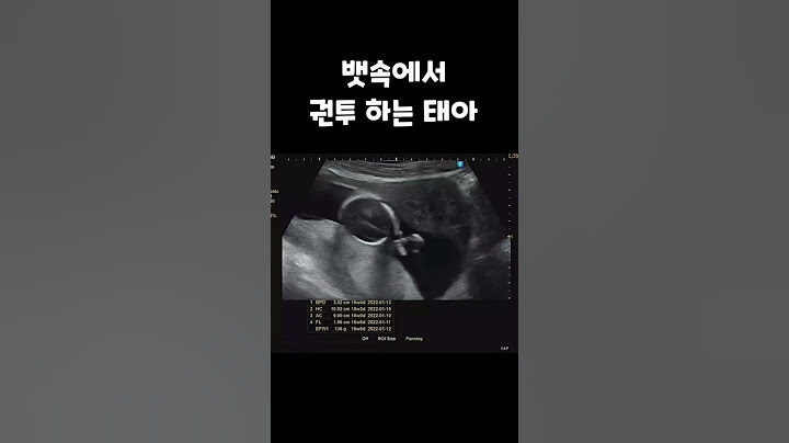 빛 보다 빠른 손 #임신15주 초음파