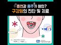 건강 매거진 흡연과 음주가 원인 구강암의 진단 및 치료 