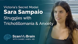 Victoria's Secret Model Sara Sampaio Struggles with Trichotillomania & Anxiety