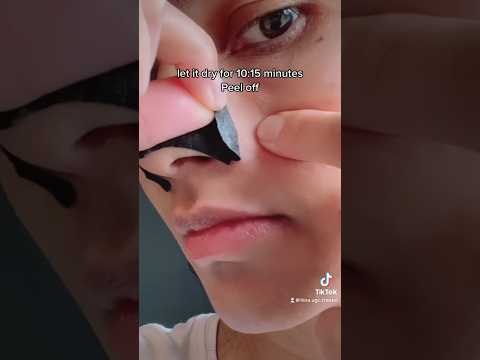 Remove nose blackheads with these. #blackheads #blackheads remove #blackheadsremover #whiteheads @hina.ugc.creator