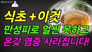 식초 이렇게 드시면 보약보다 좋습니다. 엄청난 식초효능!