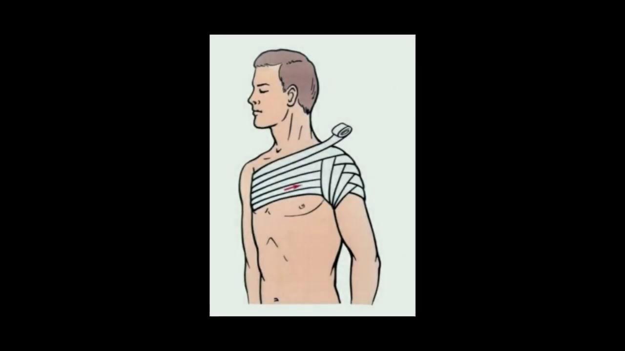 Техника наложения повязки на плечо. Колосовидная повязка. Косыночная повязка на грудную клетку. Колосовидная повязка на плечевой сустав. Восходящая повязка на плечевой сустав.
