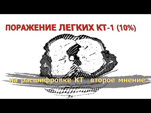 2 х сторонняя ПОЛИСЕГМЕНТАРНАЯ ПНЕВМОНИЯ поражение легких 10 процентов на РАСШИФРОВКЕ КТ (2 мнение)