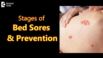 BED SORES (DECUBITUS ULCERS): Stages, Causes, Symptoms & Treatment-Dr.Aruna Prasad | Doctors' Circle