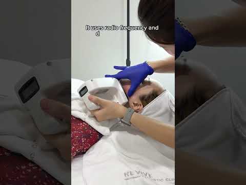 Face Lifting And Skin Tightening Treatment