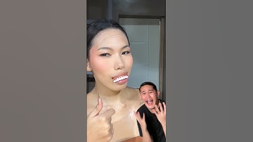 Wow! Beautiful Smile! 😬🤣 #shorts