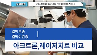 결막부종,결막이완증 치료비교분석 고주파침 아크트론 vs 엘만 vs 아르곤레이저