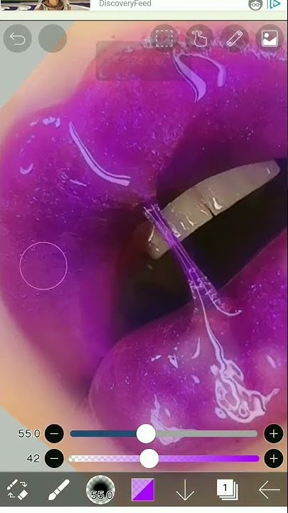 2ml в губах