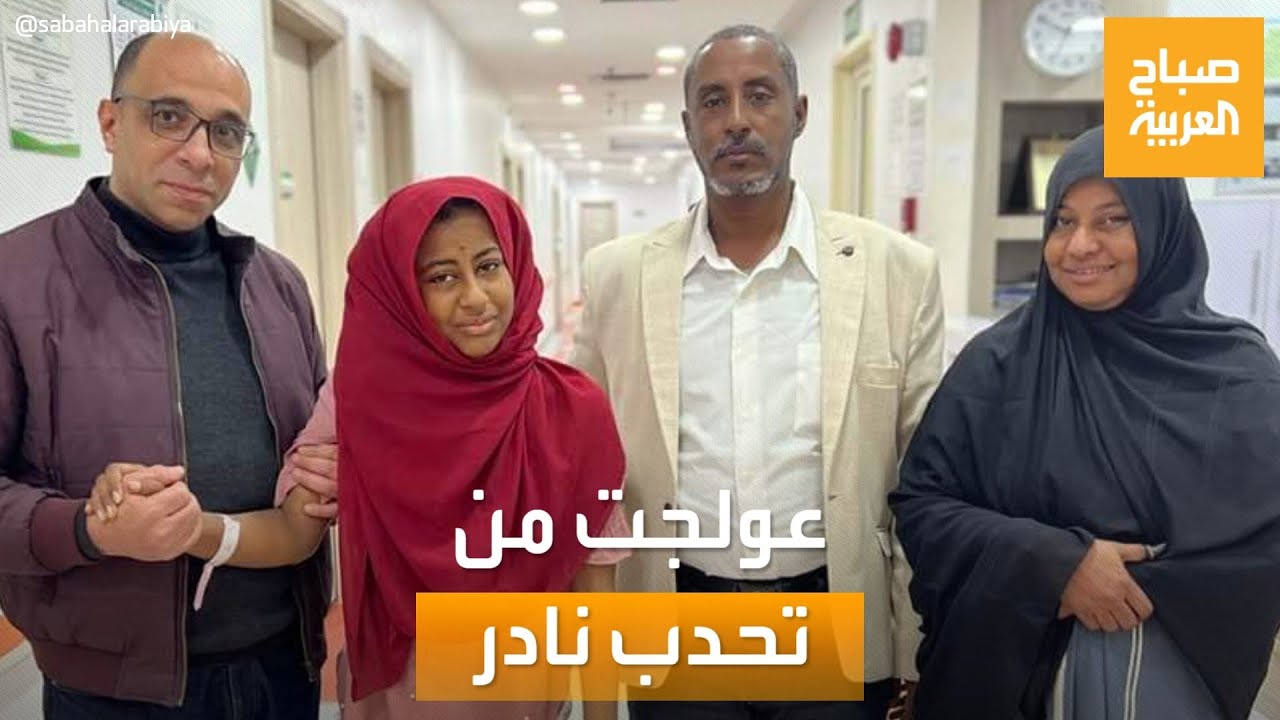 صباح العربية | والد الطفلة السودانية يكشف كيف عولجت ابنته من تحدب نادر بالعمود الفقري