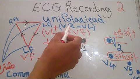 CVS new system (ECG recording part 2) dr mohamed fayez