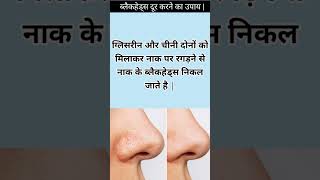 ब्लैकहेड्स हटाने के घरेलू उपाय :😱 Home Remedies for Blackheads Removal #shorts #viral #blackheads screenshot 2