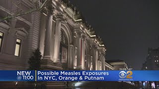 Possible Measles Exposure In NY